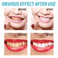 thumbnail image 3 of Gel Blanqueador Dental ANGGREK Gel Reparador De Dientes Para El Cuidado Bucal 3 Piezas, 3 of 7