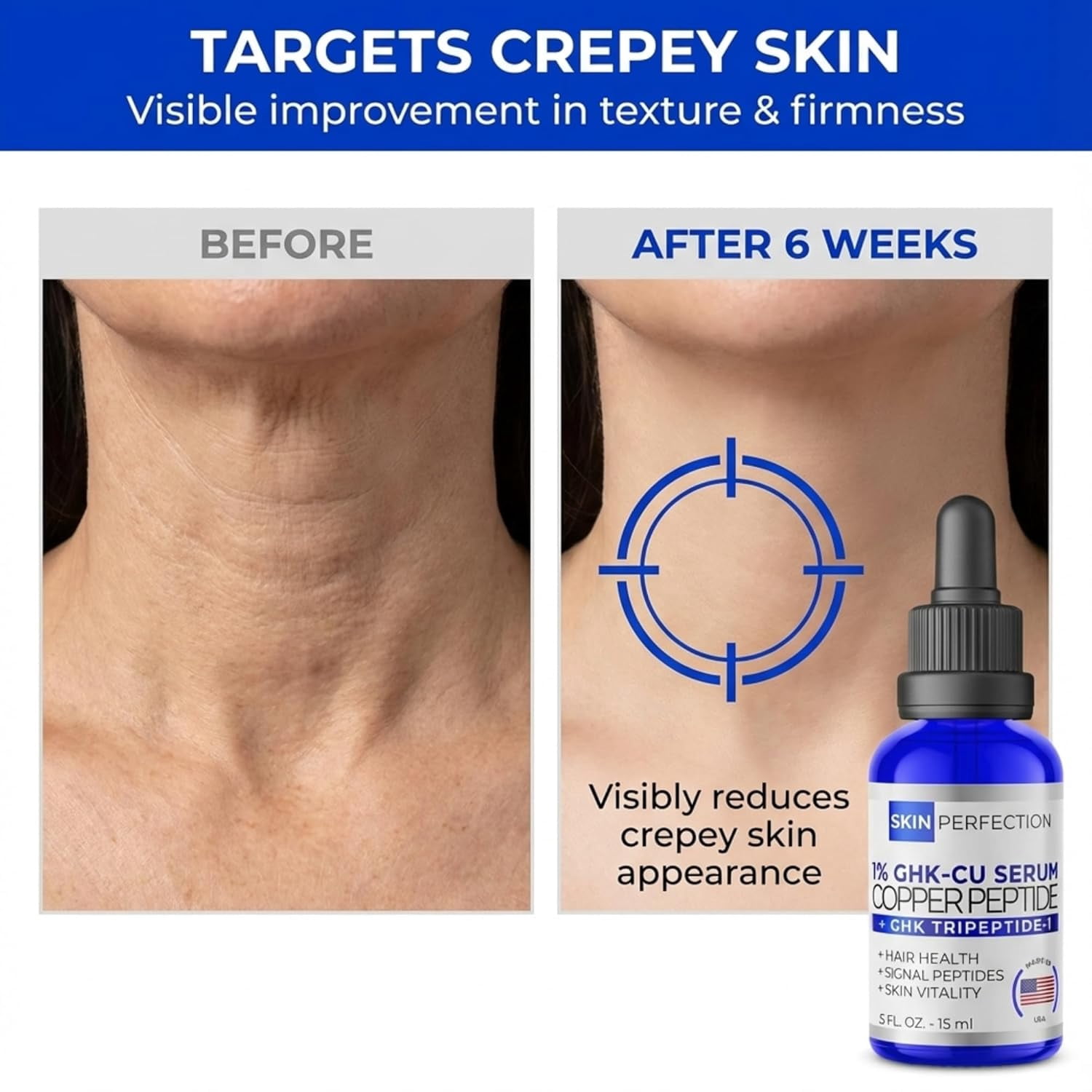 glutathione iv skin lightening before and after glutathione iv skin before and after Glutathione + Vitamin C IV Drip  Results in Delhi – 21 Day Skin Brightening & Glow Improvement