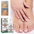 thumbnail image 2 of Essential Oil Nail Fungus Repair Liquid Nail Thickening Discoloration Off Soft Nail Thickening Type Onychomyc 20m, 2 of 5
