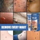 thumbnail image 3 of Ygjytge Crema Portátil Para El Cuidado De La Piel Del Tratamiento De Las Verrugas Del Cuerpo Del Gel De Eliminación De Manchas Instantáneas Ygjytge Para estrenar, 3 of 9