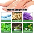 thumbnail image 4 of Pomada Para Psoriasis, Fácil De Absorber, Segura, 3 Unidades Que Reducen El Enrojecimiento Cada 20 G, Pomada Hidratante Para Aliviar La Picazón Y Eczema Para Manos, 4 of 7