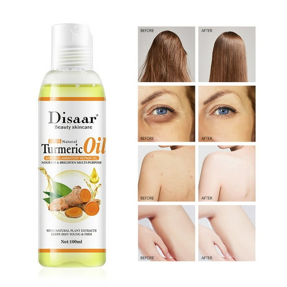 Fiudx Aceite Corporal de Cúrcuma, Fórmula Hidratante Ligera, Suavizante Nutritivo para La Piel, Potenciador Del Contorno de Ojos, Tratamiento de Hidratación Diaria, para Todo Tipo de Piel, 100 Ml de