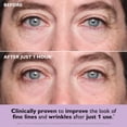 thumbnail image 4 of Mascarilla para el tratamiento de la piel Peter Thomas Roth Instant FirmX Eye Patches, 4 of 7