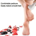 thumbnail image 3 of Electric Foot Callus Remover Kit, Rechargeable Pedicure Tools Foot Care Feet File With 3 Heads,2 Speed,Battery Display for Remove Cracked Heels Calluses and Dead Skin, 3 of 8