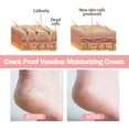 thumbnail image 4 of Hoygi Anti-Crack Hand And Foot Moisturizer, Foot Care Anti-Crack And Dead Skin, Hand And Foot Skin Moisturizer, 4 of 6