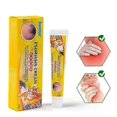 thumbnail image 2 of Psoriasis Ointment, Eczema Cream Psoriasis Antipruritic Ointment Dermatitis Eczematoid Inhibit Bacteria Antibacterial Cream 20g, 2 of 5