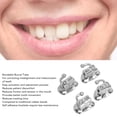 thumbnail image 3 of Tubo bucal Roth segundo tubo bucal adherible portátil Roth que corrige los dientes desalineados y reduce la fricción oral para el hospital ANGGREK Otros, 3 of 8