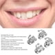 thumbnail image 3 of Tubo bucal molar Roth segunda fricción oral reducida 40 piezas Tubo bucal adherible Roth que corrige dientes desalineados para dientes ANGGREK Otros, 3 of 8