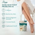 thumbnail image 2 of Fivona Tea Tree Foot Soak Blend 14.1 oz - Epsom Salt with Essential Oils for Callus Softening, Soothing Relief, Healthy Toenails, 2 of 8