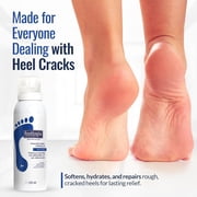 Footlogix Cracked Heel Cream – Intensive Moisturizing Foot Repair for Dry, Rough Feet & Calluses, Fast-Absorbing, 4.23 oz