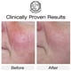 thumbnail image 4 of Cream Beauty Facial Extreme Vitamina K Hidratante, 4 of 8
