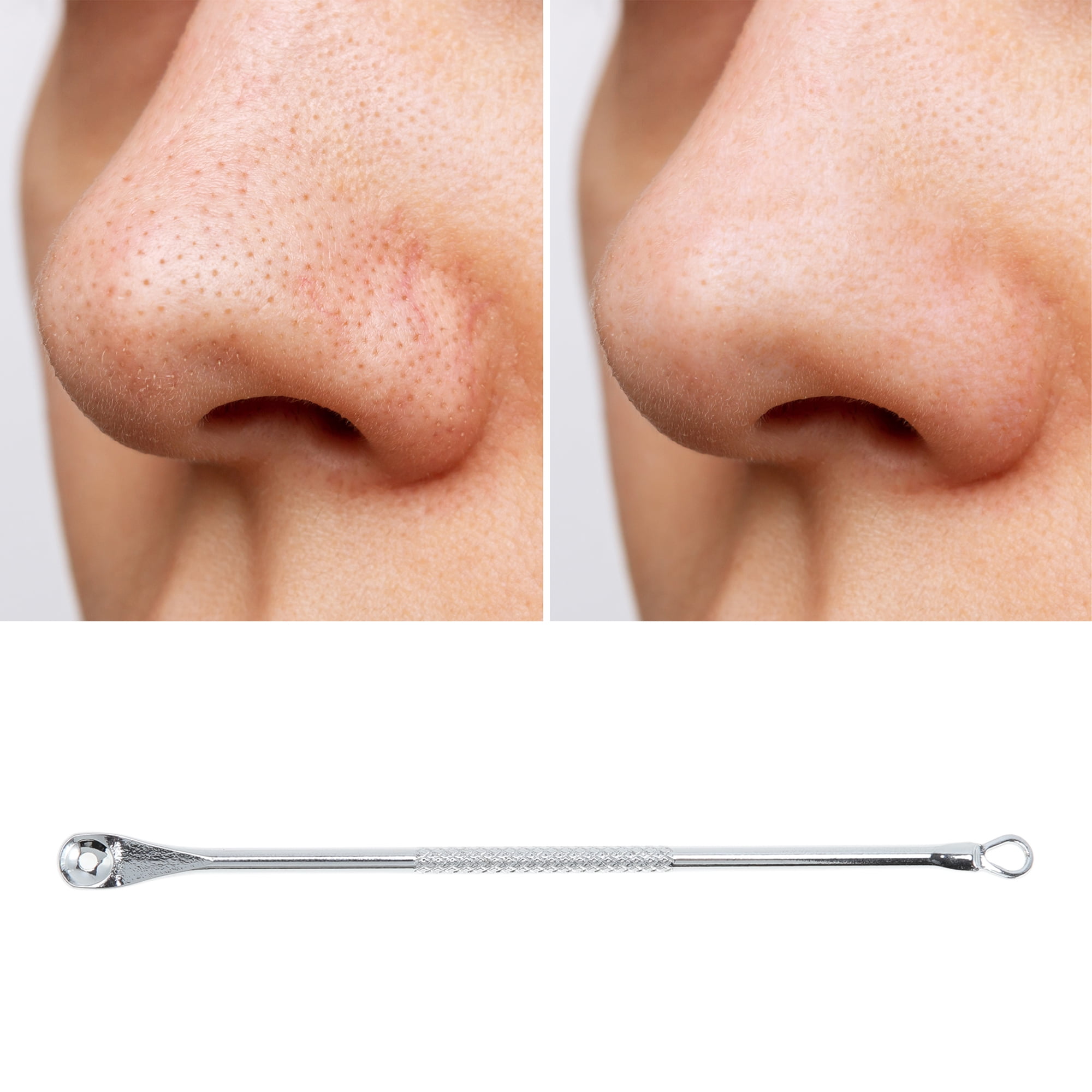 Unique Bargains 1pc Durable Squeeze Pimple Extractor Tool for Grooming Silver Tone