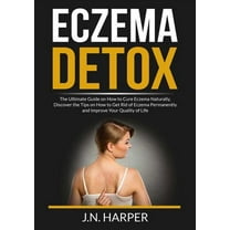 Eczema Detox: The Ultimate Guide on How to Cure Eczema Naturally, Discover the Tips on How to Get Rid of Eczema Permanen, (Paperback)