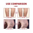 thumbnail image 2 of Tratamiento para venas varicosas en piernas, crema calmante para venas varicosas y piernas, fortalece la salud capilar y reduce las arañas vasculares, 3 unidades, 2 of 5