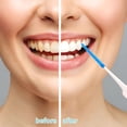 thumbnail image 6 of ACDANC 100 Pieces Interdental Brushes,Silicone Dental Floss Picks with Case,Blue Tooth Floss Picks for Teeth Cleaning, 6 of 7