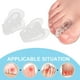 thumbnail image 4 of Separadores de s de los pies, Corrector de juanetes, cómodo, , para juanetes, , previene , los , almohadil Zulema Separadores de dedos, 4 of 8