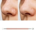 thumbnail image 5 of Unique Bargains 1pc Portable Double-Headed Pimple Extractor Tool Rose Gold Tone, 5 of 6
