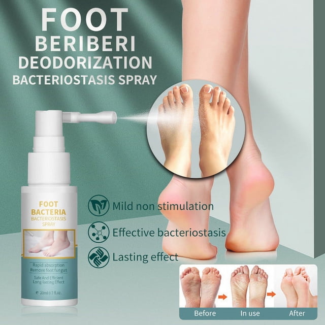 Aceite Líquido En Aerosol para El Pie de Atleta | Extra Fuerte (20 Ml) - Desodorante Homeopático Vegano para Pies y Eliminador de Olores