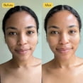 thumbnail image 2 of Mascarilla facial DR MEINAIER Luxury Rose Anti-Acné Rejuvenece, 2 of 5