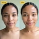 thumbnail image 2 of Mascarilla facial DR MEINAIER Luxury Rose Anti-Acné Rejuvenece, 2 of 5