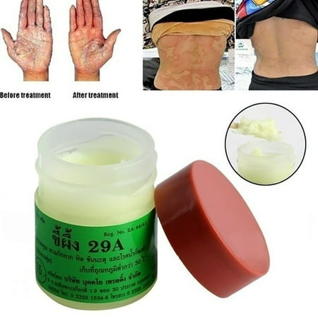 Psoriasis Cream Chinese Herbal Antibacterial Eczema Treatment Psoriasis Anti-itching