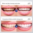 thumbnail image 5 of Livfresh Toothpaste Gel, Clinically Proven To Remove Plaque 250% Better, 5 of 5