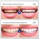 thumbnail image 5 of Livfresh Toothpaste Gel, Clinically Proven To Remove Plaque 250% Better_i*, 5 of 5