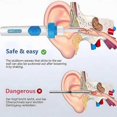 thumbnail image 3 of Oroclear Earwax Remover, Electric Ear Cleaner, Oroclear Ear Wax suction Remover, 3 of 5