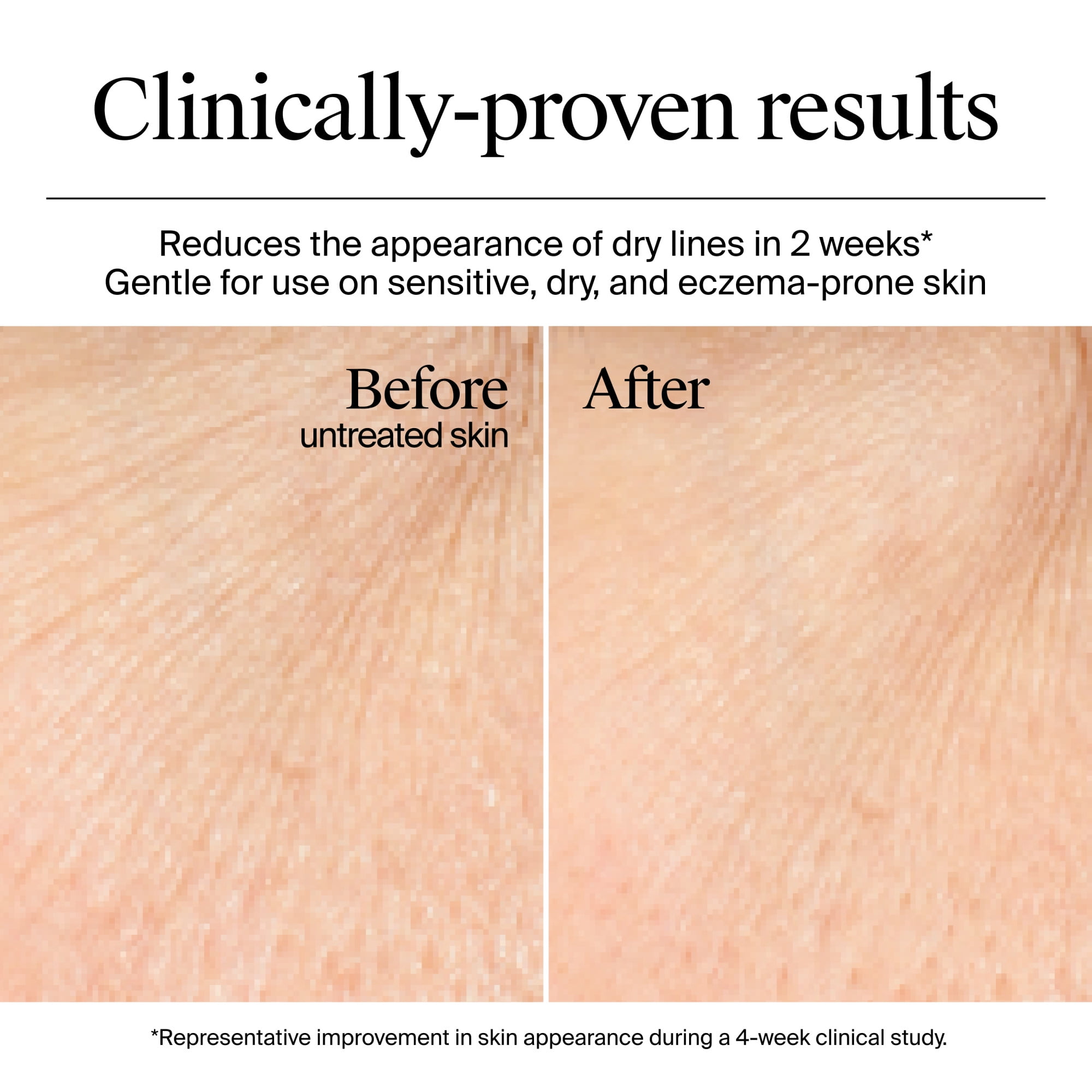 Neutrogena Hydro Boost Fragrance Free Face Moisturizer with Hyaluronic Acid for Dry Skin, Gel Cream Moisturizer For a Refreshing Burst of Hydration & Glowing Skin, Non-Comedogenic