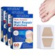 thumbnail image 1 of 3PCS Ingrown Toenail Correction Tool Toenail Treatment Corrector Stickers, 1 of 5