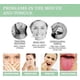 thumbnail image 3 of 1-3X Tongue Repair Spray 30ml Reduce Swelling Tongue Relief Treatment Spray for Bad Breath, Tongue Repair Spray for Dryness& Bad Breath, 3 of 5