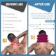 thumbnail image 3 of Dispositivo de tracción cervical para aliviar el dolor de cuello. Collarín inflable ajustable y aparato de tracción cervical. Dispositivo de descompresión cervical para uso doméstico (rojo)., 3 of 7