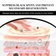 thumbnail image 4 of Whitening, Brightening, Secondary Polishing Capsule,30ml, 4 of 9