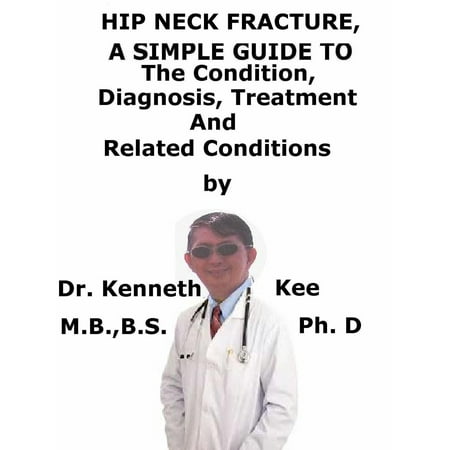 Hip Neck Fracture, A Simple Guide To The Condition, Diagnosis, Treatment And Related Conditions -