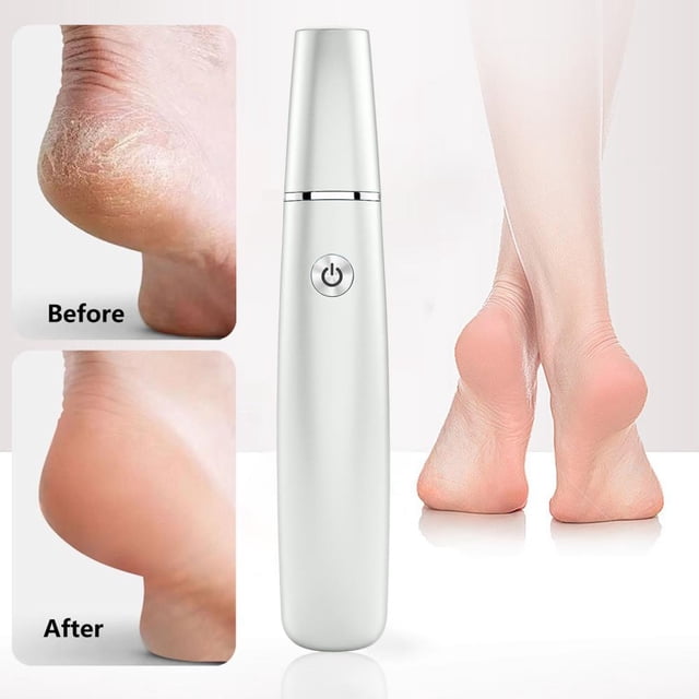 Feltree Charging Foot File with Multiple Speeds - Portable Callus Remover for Home Use
