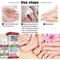 thumbnail image 5 of Fungal Nail Treatment For Toenails Extra Strong,nail Fungus Treatment For Toenail,toenail Fungus Treatment, 5 of 5