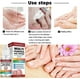 thumbnail image 5 of Fungal Nail Treatment For Toenails Extra Strong,nail Fungus Treatment For Toenail,toenail Fungus Treatment, 5 of 5