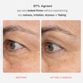 thumbnail image 2 of Crema para ojos First Aid Beauty Retinol con escualano+ceramidas, 15 ml, 2 of 8
