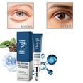 thumbnail image 4 of Potrochi Eye Gel, Puffy Under Eye Serum, Cooling Under Eye Cream For Dark Circles, Puffiness and Bags under Eyes, Morning Under Eye Serum, Night Eye Cream - Beauty Gifts for Women, 4 of 8