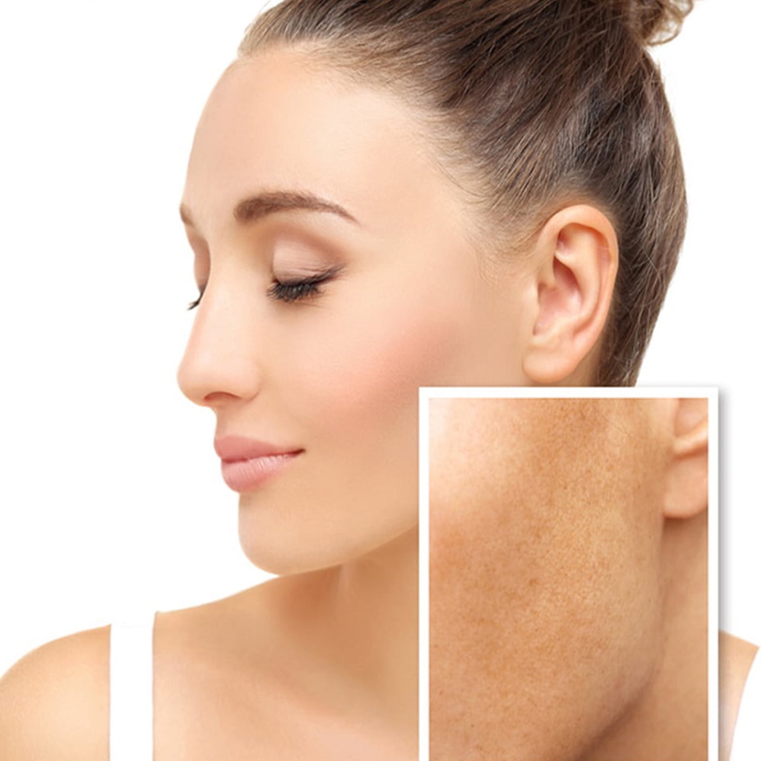 Mesoestetic Melan Tran3X Gel Cream 50 ml / 1.7 oz
