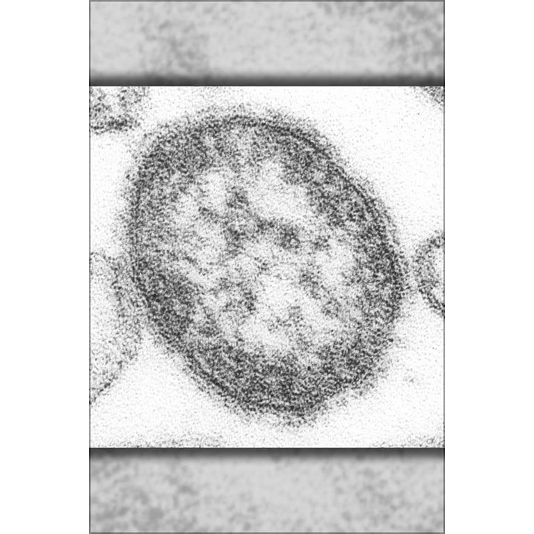 Rubeola Virus Microscope