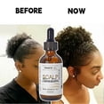 thumbnail image 3 of Scalp Stimulator Hair Growth Oil, Advanced Scalp Care Hair Growth Serum for All Hair Types, 3 of 5