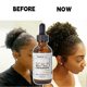 thumbnail image 3 of Scalp Stimulator Hair Growth Oil, Advanced Scalp Care Hair Growth Serum for All Hair Types, 3 of 5