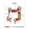 Colon Model, for Human Anatomy and Physiology Education, Anatomy Model ...