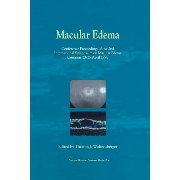 Macular Edema: Conference Proceedings of the 2nd International Symposium on Macular Edema, Lausanne, 23-25 April 1998, (Paperback)