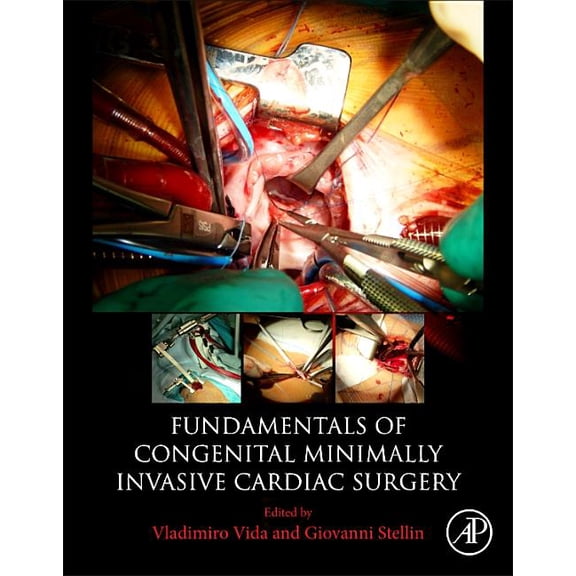 Fundamentals of Congenital Minimally Invasive Cardiac Surgery, (Paperback)