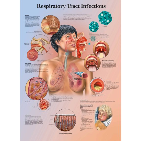 Respiratory Tract Infections Wall Art Posters Canvas Print Artwork Wall Chart Human Anatomy Wall Painting Office Hospital Room Home Decoration (without Framed),Multicolor,16x19.7 inch(40x50 cm)