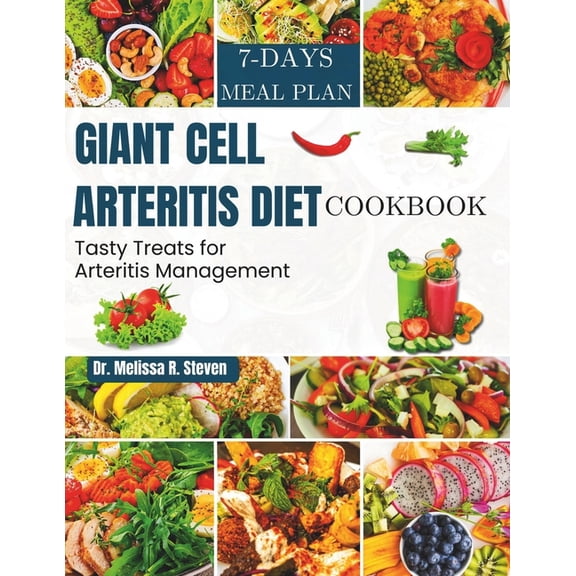 Giant Cell Arteritis Diet Cookbook: Tasty Treats for Arteritis Management, (Paperback)