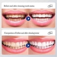thumbnail image 5 of Livfresh Toothpaste Gel, Clinically Proven To Remove Plaque 250% Better_c*, 5 of 5