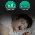 thumbnail image 2 of Anti Snoring Equipment Electric Mini Cpap Snore Stop Device Snore Stopper Corrector White, 2 of 5